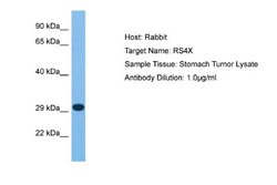 RPS4X Rabbit anti-Human, Polyclonal, Novus Biologicals 0.1 mL | Buy Online | Novus Biologicals | Fisher Scientific